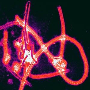 Color-enhanced electron micrograph of Ebola virus particles. Image: Thomas W. Geisbert/ Boston University School of Medicine — Creative Commons