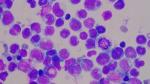 Cancer cells_846.jpg.fit.300x169