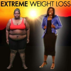 Mitzi White - Extreme Weight Loss