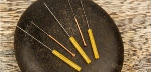 Some women being treated with acupuncture in a study experienced a 36.7 percent decline in the frequency of their hot flashes. 