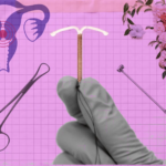 Why Is Gynecology Still Using a Civil War-Era Tool?