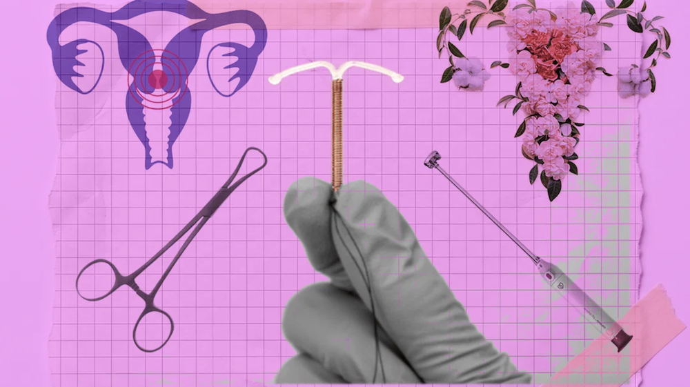 Why Is Gynecology Still Using a Civil War-Era Tool?